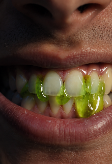 Venom Gum community photo 2